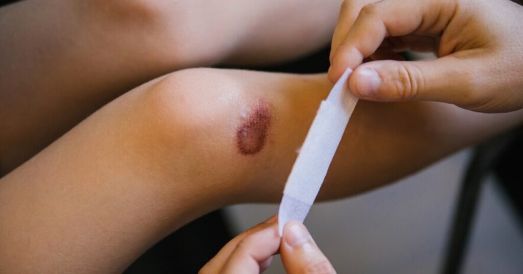 Chronic Wounds