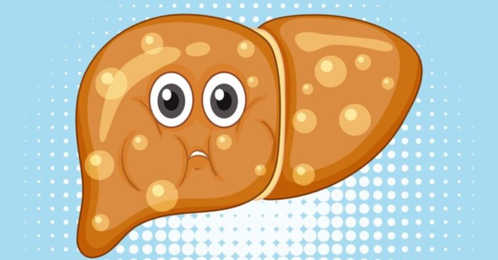 Fatty Liver