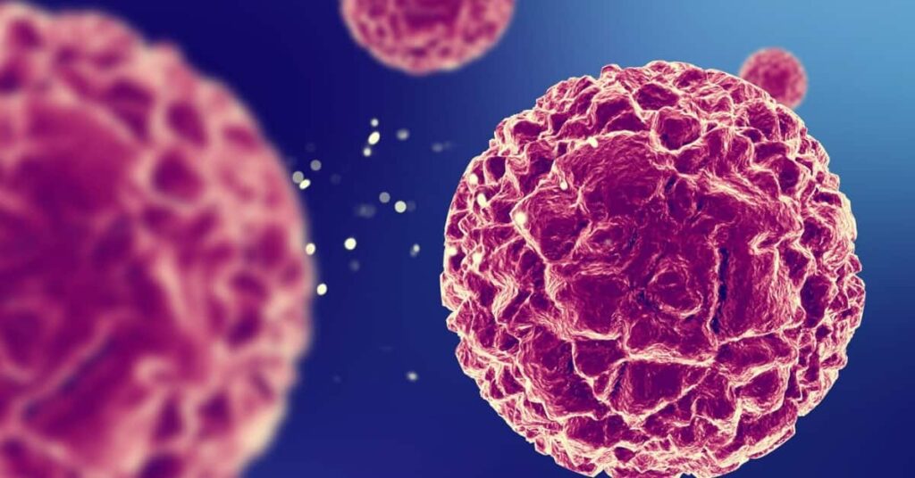 High Eosinophils