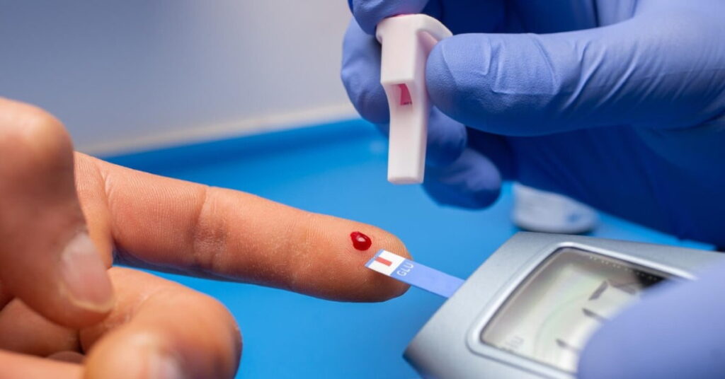 Hyperglycemia