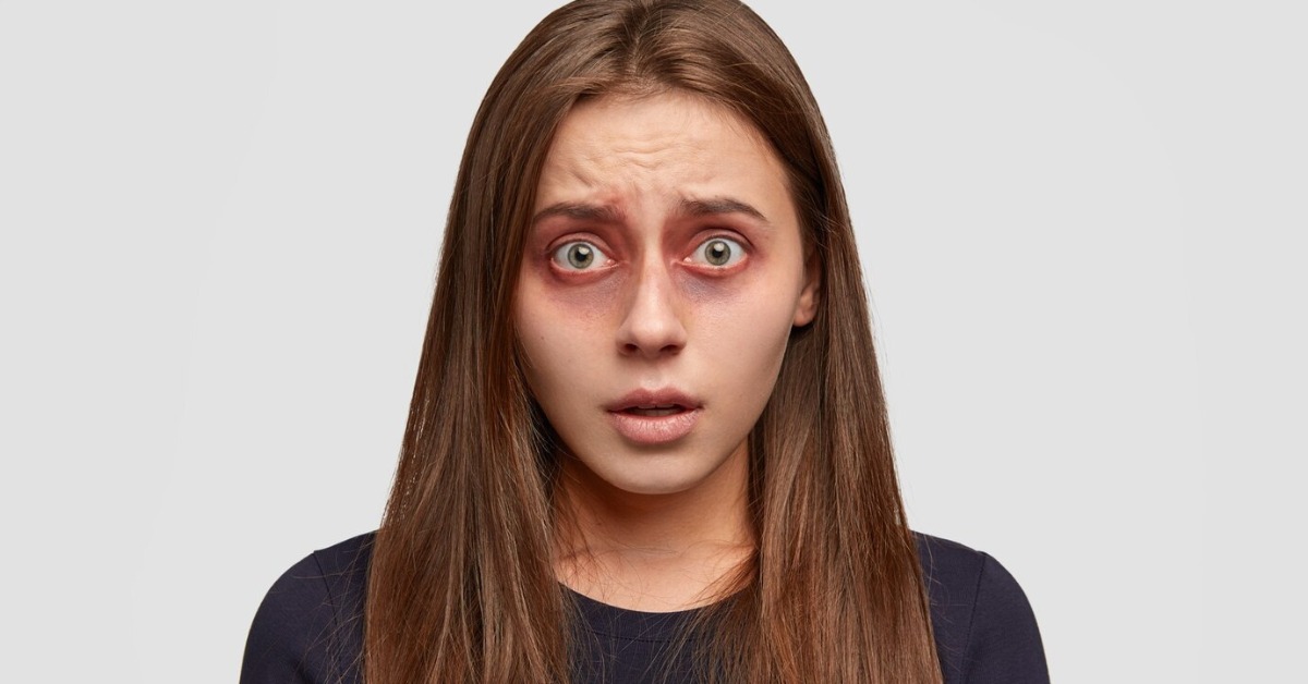 Red Eyes