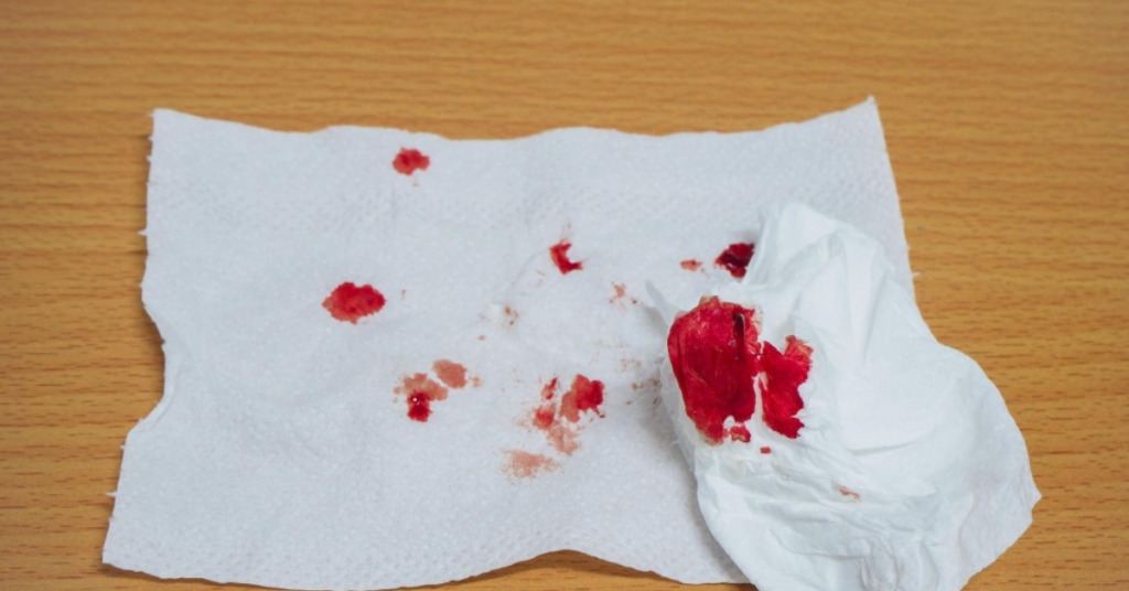 खून की उल्टी