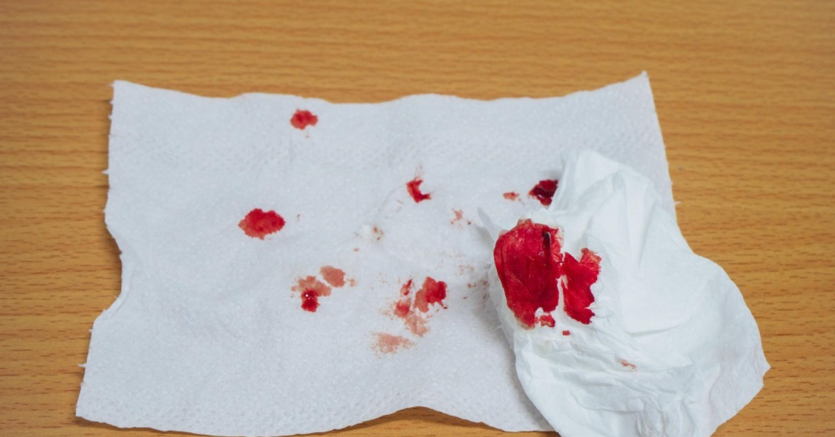 खून की उल्टी