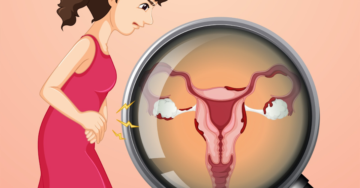 योनि में खुजली