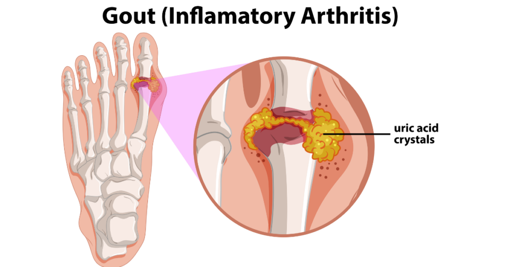 rheumatologist in indore