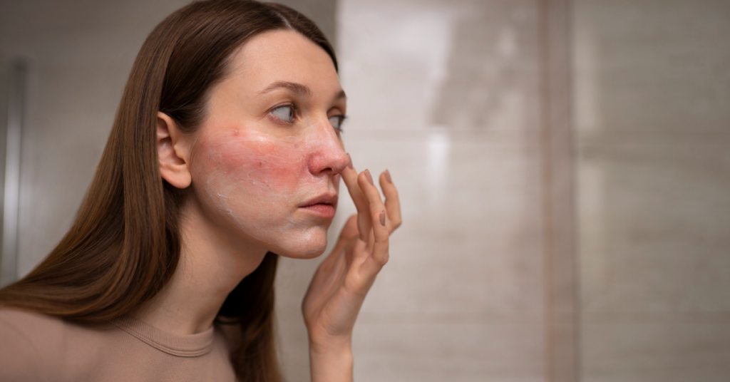 dermatologist in indore