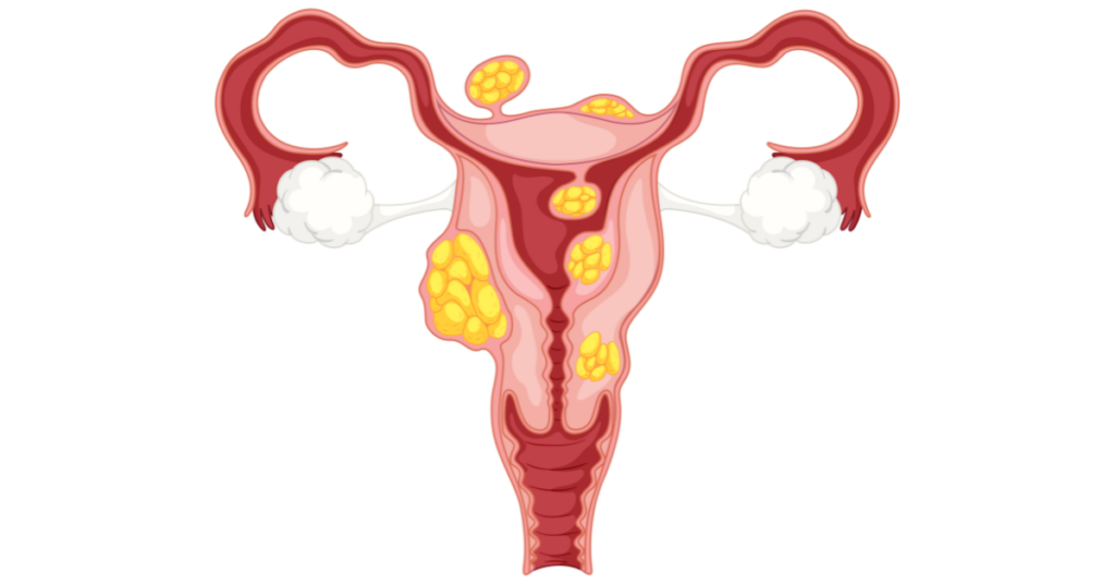 gynecologist in indore