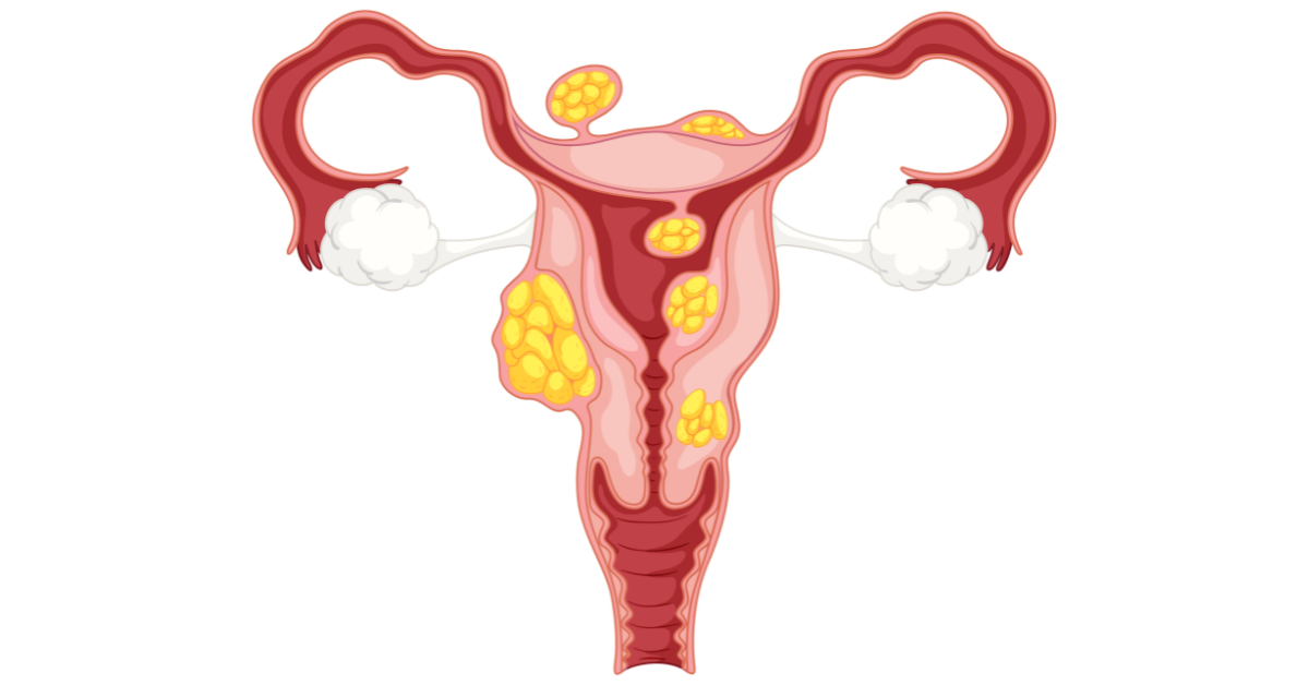 gynecologist in indore