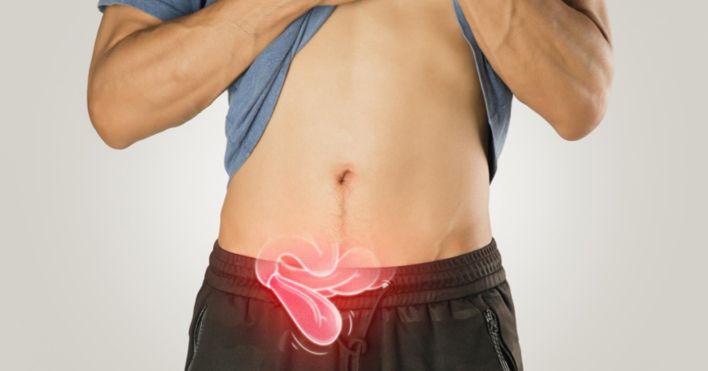 नाल हर्निया