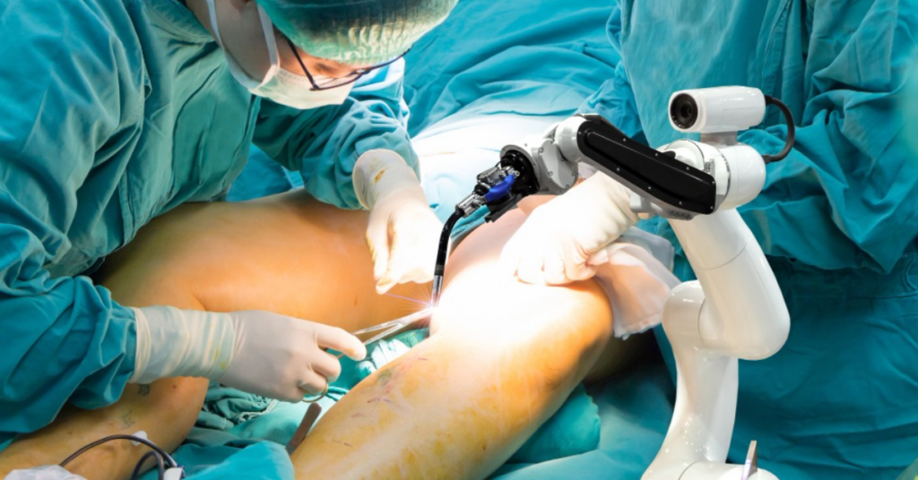 पाइल्स सर्जरी