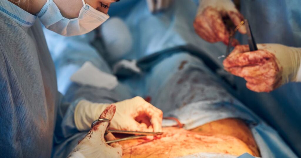 Hernia surgery in Indore procedure recovery time and when to operate