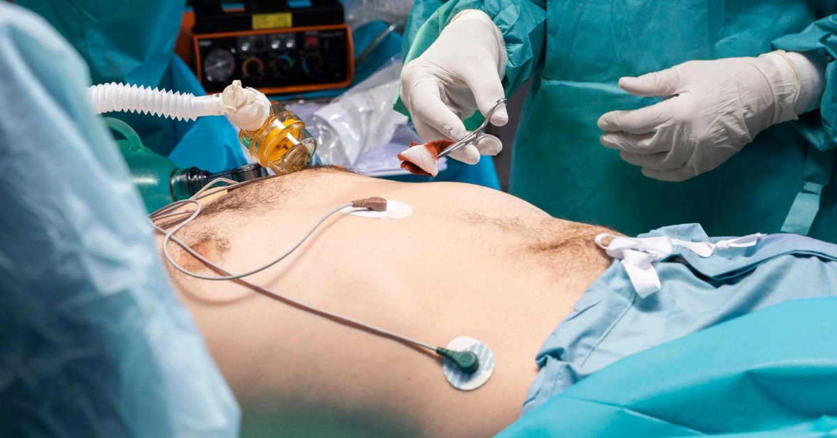 risks of delaying hernia treatment explained by hernia surgeon in indore