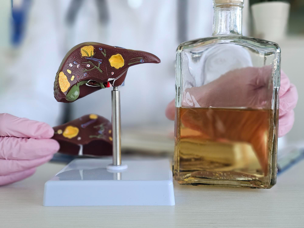 Ayurvedic alcoholic liver disease treatment in Indore for natural liver care and recovery support